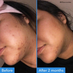 Good Molecules Discoloration Correcting Serum 30 ml