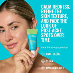 Good Molecules 10% Azelaic Acid Treatment 30ml
