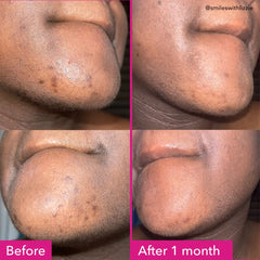 Good Molecules Brightening & Dark Spots Bar 85g
