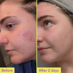 Good Molecules 10% Azelaic Acid Treatment 30ml